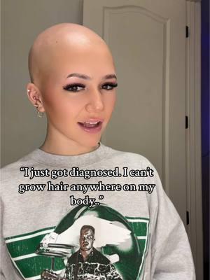 I dont care NOW but at the beginning of adjusting to alopecia- hearing this would just hurt🙃 i wanted to experience normal girl things like shaving. NOW i think it is a perk! but at the beginning no😅#chronicillness #alopeica #trend #fyp #bald #autoimmunedisease 