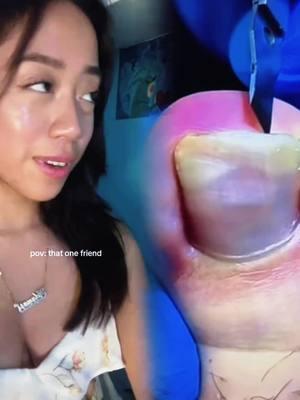 #ingrowntoenail #ingrowntoenailremoval #podiatrist #toenails #pedicure #manicure#podiatry #feet #tiktok #fyp#orvou #pov #foryourpage #relatable #satisfying #viral #tacting #actingvideos #asmrvideo #parents #relatable #family #childhood #parenthood #child #fyp