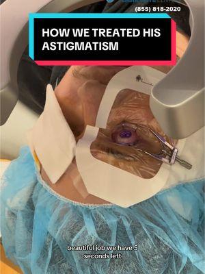 How we treat his astigmatism during LASIK eye surgery #tiktok #lasik #lasikeyesurgery #vision #ophthalmology #ophthalmologist #fyp #visioncorection #doctorsoftiktok #surgeonsoftiktok #eyesurgery 