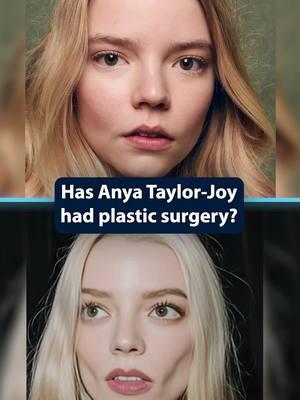 Anya Taylor-Joy's NEW LOOK #AnyaTaylorJoy #celebrities #PlasticSurgery #PlasticSurgeon #Surgeon #Surgery