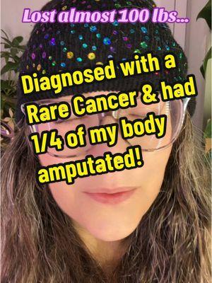Of course this would happen… It took me about 3 years to lose almost 100lbs. I started off slowly by walking during my lunch break (took almost an hour to walk a mile), which turned into running (was running a 5k in 30 minutes by the end). After about 6 months of walking, I started just slowly cutting my food portions when I ate but never cut out anything. One day I was running & the next day my entire body hurt, like I had fallen down a set of stairs & my leg started swelling. Went to the dr. & within a cpl months I was diagnosed with a rare cancer called Pleomorphic Liposarcoma. 5 months later I had a 3 day long (over 55 hrs) surgery (with 5-6 suregons) to remove the tumor. My leg/hip was fully amputated (along w/part of my spine & pelvis), called an external hemipelvectomy a couple months later. Then about 8 months after that, I lost the sight in one of my eyes & a few months after that, had a nephrostomy tube put in. A lot of other issues (like that wasn’t enough!) happened during that time which I’ll make a video about soon. #fyp #fypシ゚viral #foryoupage #cancer #cancersurvivor #rarecancer #pleomorphicliposarcoma #liposarcoma #sarcoma #hemipelvectomy #externalhemipelvectomy #rareamputation #legamputation #amputee #meme #darkhumourandjokes #darkhumorjokes #darkhumormemes #darkmemes #wowihaventstubbedmytoeiffivemonths #wtf #cancersucks #fuckcancer #ihatecancer #medicalhumor #medical #medicaltiktok #medicaltok #cancertok #amputeetiktok #notfunnyhahafunnyweird #weightloss #weightlossjouney #weightlossstory #cancerstory 
