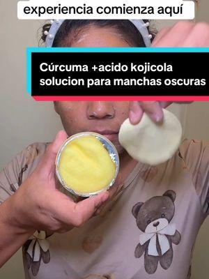 Funcionaran estad almohadillaspara manchas oscuras mi esperiencia comienza. Aquí #almoadillatumeric #PielRadiante #CuidadoDeLaPiel #SkincareTips #ManchasOscuras #RutinaDeBelleza #BeautyHacks #TurmericSkincare #ÁcidoKójico #AntesYDespués #SkincareChallenge#TikTokShop #foryou #lyapineda806shop 