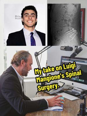 As a spine surgeon who mainly focuses on revisions, this is my take on Luigi Mangione‘s spine surgery. #luigi #luigimangione #united #unitedhealthcare #spine #spinesurgery #fusion #fy 