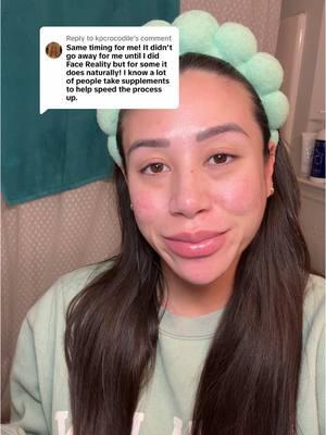 Replying to @kpcrocodile acne is such a beotch 🙃 #postbirthcontrolsyndrome #postbirthcontrolacne #postbirthcontrolproblems #acne #acnetreatment #acneskin #acneproneskin #acneskincare #acnefighter #acnecheck 