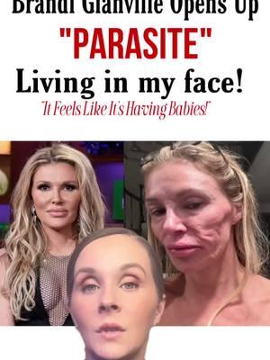 Reality Tv Star Brandi Glanville Opens Up About Mystery Medical illness Thats Kept Her in Hiding For Almost A Year! #brandiglanvilleunfiltered #brandiglandville #realhousewives #realhousewivesoftiktok #realhousewivesofbeverlyhills #realhousewivestiktok #bravotv #bravo #bravotvaddict #realitytv #reality #realityshow #realitytvshow #realitytvnews #celebrity #celebrities #celebritynews #celebritytiktok #celebritygossip #mysteryillness #parasite #trending #trend #trendingtopic #viralvideo #viraltiktok #fyp #fypシ #fypシ゚viral #foryoupage #fypage #foryoupage #foru 