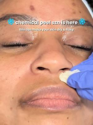 They don’t call it chemical peel season for nothing! 🤩 Since post-care involves staying out of the sun, shorter days make winter the BEST time to invest in a chemical peel, as reduced sun exposure allows your skin to heal and renew safely. 👩‍⚕️ #chemicalpeel #blackgirlskincare #blackesthetician #chemicalpeeljourney #winterskincare