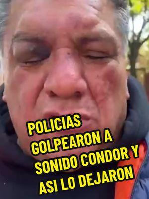 #POLICIAS GOLPEAN AL SENOR ARNULFO AGUILAR - sonido condor#policias#policiasmexico #policiascorruptos #policeacademy #sonidocondor🇲🇽 #sonidocondor🤘 #sonidocondorarnulfoaguilera😎🎤🎧🎵🎼🎶 #elgigantedelossonidosenmexico #labanderadelossonidosenmexico #hermandadsonidera #hermandadsonideraphoenix #hermandadsonideradehuixquilucan🎤 #sonideros #soniderosdecorazon #cumbiasonidera #cumbiapoblana #dvjcharlie #losjuniorsdecalifornia #losjuniorssonideros #lachanga #sonidolachanga🦍 #sonidofamosojaimeguzman #jaimeguzmansonidofamoso #sonidosiboney #sonidofantasma #