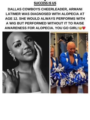 Shout out to Armani Latimer @Armani Latimer a Dallas Cowboys Cheerleader who stepped out in confidence and performed without a wig to raise awareness for Alopecia Awareness ❤️  If you love positive content like this give us a follow @successisus #positiveblackgirlvibes #positiveblackimages #alopecia #alopeciaawareness #alopecialife #alopeciagang #blackwomenoftiktok #blackwomanselfcare 