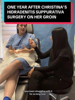 One year after Christina’s HS surgery & she’s back to share her experience #tiktok #hidradenitissuppurativa #hidradenitissuppurativawarrior #hs #hssurgery #surgeonsoftiktok #hidradenitissuppurativaawareness #groin #skindisease #plasticsurgery #plasticsurgeon #doctors #fyp #foryou #foryou 