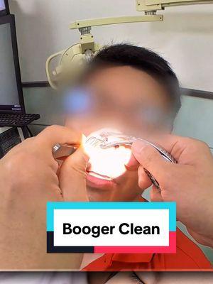 Booger was making it impossible for him to breathe through his nose. I removed it for him. #boogerremoval #booger #stuffynose #drynose #noseclean #cleaning #clean 