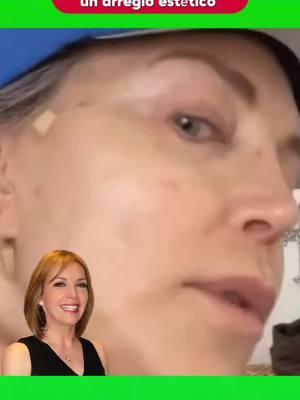 Laura Flores narro el terror que vivió al hacerse unos arreglos en el rostro #lauraflores #lauraflores_oficial #chiisme #espectáculos #rosiiochoa #mexico🇲🇽 #cirugias #belleza #foryoupage #videoviralitiktok 