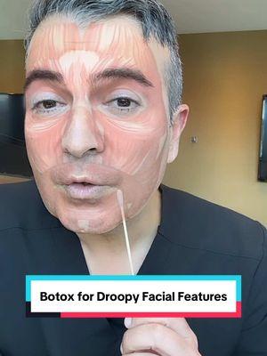 Did you know we can use #botox to treat droopy facial features? Dr. Parsa explains! #antiaging #education #kamiparsa #medspa #parsamd #xeomin #wrinkles #dysport #learntok 