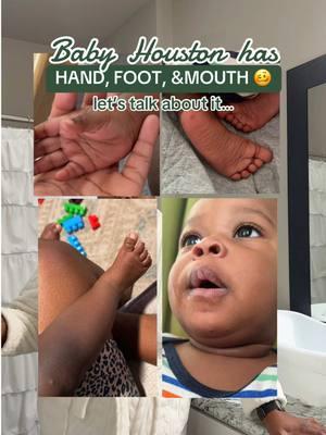 Baby Houston has Hand Foot and Mouth, so let’s talk about it! . . . #sickbaby #handfootandmouthdisease #babiesoftiktok #babies #homeremedies #MomsofTikTok #momtok #momlife #momhack #momera #sickkids #kidsoftiktok #tubbytoddmama #tubbytoddalloverointment #tubbytodd #aquaphor #breastmilkbathtime #breastmilk #breastmilktok