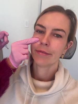 @beautybybritt_LA #botox #filler #restalyne #daxxify #medicalaesthetics #facecare #over30 #millennial #SelfCare #plasticsurgery #aging #beauty #grace 