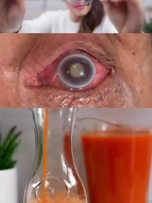 NATURAL RECIPE FOR HEALTH EYEPIECE #eyes #vision #naturalremedy #womanhealth 