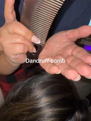 This DANDRUFF COMB actually works! I almost didnt believe it until i tried it ! ENERGY DANDRUFF COMB #dandruffremovel #dandruffcomb #dandruffsolution #hairdandruff #hairdandruffcomb #hairtok #TikTokShopHolidayHaul #giftideas #fyp 