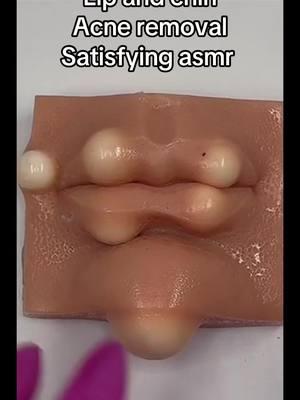 Infected lips Relaxing  #asmrsounds #asmr #viral #fypシ #relax #skincare #mouthsounds #satisfying #tingles #asmrtriggers #mochipimplepopping #pimplepoppin #acnetreatment #asmrtiktoks  #lip #lipfiller #CapCut 