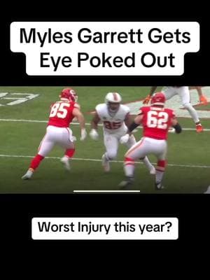 #mylesgarrett #injury #eyepoked #gruesome #injured #nasty #badinjury #eyeinjury #havetosee #seethis #nfl #foryou #foryourfeed #foryourpage #fyp #viral #trending #blowup #blowthisup 