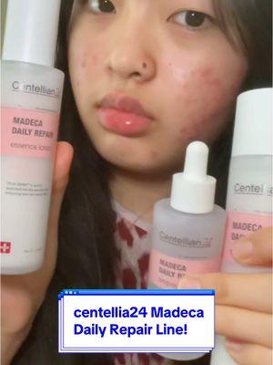 i might be biased, but i like anything with centella tbh LOL! #koreancream #madecacream#centellian24 #centellacream #activeteca #sensitiveskin #acneproneskin #acne #acneprone #teca #koreanbeauty #kbeauty #beauty #kskincare #koreanskincare #skincare  #viral #trending #fyp #shadowbanned @Centellian24_global @centellian24_official  #Inverted 