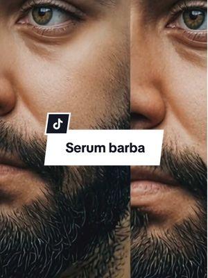 Este #serum para la barba de sefudum, diseña para el crecimiento y cuidado de tu barba #barba #beard #beardlook #beards #men #productosparahombres #barbados #serum #beardgrowth #hairgrowth #beardmen 