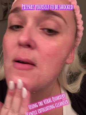 When i say QUARXERY delivered on this product……. They delivered…… never in my life didni think i had that much dead skin on my face…. Now i know why this product is VIRAL. Runnnnnnnnnn this will sale out so fast…… @QUARXERY USA  #quarxery #quarxerygentleexfoliation #exfoliate #exfoliation #facial #clean #dryskin #sensitiveskin #dullskin #oilyskin #deadskin #deadskincells #skincare #skincareroutine #SkinCare101 #musthaves #recommendations #highlyrecommended #gift #giftideas #giftforall #giftforher #giftforhim #MomsofTikTok #woman #men #selflove #SelfCare #tiktokmademebuyit #influencer #contentcreator #skincarereview #fyp #fypシ #foryoupage #foryourpage #trending #viralvideo #goviral #blowthisup #dontletthisflop #support #treatyourself #buyit #christmas #christmasgift 