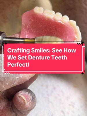 Crafting Smiles: See How We Set Denture Teeth Perfectl : #DentureCare #BeautifulSmile #PerfectFit #SmileTransformation #CustomDentures #DentureLab #SmileGoals #DentalCraft #DentureMaking #SmileDesign #RealisticTeeth #SmileWithConfidence #TeethSetup #CraftingTeeth #NewSmile #DentureTeeth #PerfectTeeth #FlexiblePartials #SmileArt #DentureLife #BehindTheScenes #DentureProcess #HandcraftedSmile #LabWork #DentalTechnician #PrecisionWork #DentureSteps #SmileCreation #TeethCrafting #WaxTryIn #ComfortableDentures #DentureFit #CustomFit #NoMorePain #SmileUpgrade #BestDentures #PerfectSmile #SmileComfort #HighQualityTeeth #SmileSolution #FixYourSmile #DentureRepair #DentureTips #BeforeAfterSmile #ClientSmiles #BeautifulResults #TeethGoals #PerfectDentures #DentureJourney #DentalSolutions #UpgradeYourSmile #TransformYourSmile #ProfessionalDentures #SmileMatters #AffordableDentures #TopDentures #SmileExperts #HealthySmile #SmileEveryday #CustomSmile #SmileStyle #NaturalLook #DentureArt #TeethTransformation #SmilePerfection #CraftedSmile #3DSmile #LifeChangingSmile #TeethDesign #SmileBeauty #DIYDentures #CustomKits #FlexibleDentures #DentureDIY #SmileDIY #BiteBlock #WaxTryInSteps #HomeSmileKit #DentureSolutions #FlexiblePartials #ConfidenceBoost #FeelGoodSmile #YourBestSmile #BeProud #OwnYourSmile #PositiveVibes #BeautifulResults #NewYou #SmileGoalsAchieved #TeethConfidence #WatchThis #SmileTutorial #CraftedWithCare #SmileJourney #TeethInFocus #RealResults #DenturesDoneRight #TrendingSmiles #ShareYourSmile #InspiredSmiles