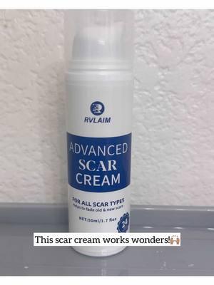 I was so scared my sons face was going to be scarred for life but this cream is giving me hope! 🙏🏽♥️ Its only been 2 weeks since his accident and he’s healing beautifully! Highly recommend this scar cream for both new and old scars. . . . . . . . . . #burns #scarringskincare  #scars #skincare #healingscars  #scarcream #scars #healing #roadrash #fyp