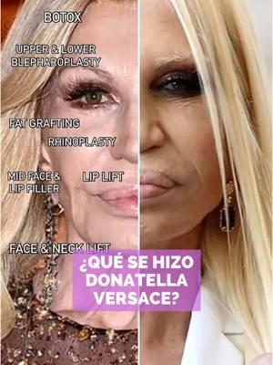 El mundo de la belleza está cambiando: ahora, lo natural es lo perfecto. Menos es más, y la autenticidad se lleva la corona #chinitasbydailyn #miamilakes #fillers #estética #injectablestreatment #donatellaversace #cirugias 