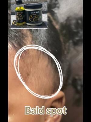 Watch this before and after. Ive been using Lachel beaute products on my daughter since she was 2 weeks old and her hai has thanked me for it ! #curlyhair #hairgrowth #hairgrowthtips #hairgrowthjourney #naturalhair #healthyhair #lachelbeaute