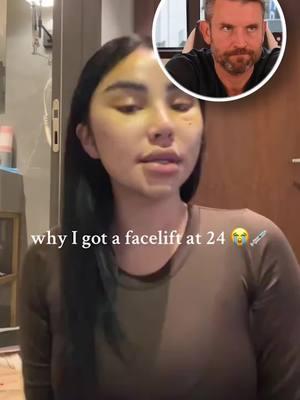 Facelift at 24?! 😱 #plasticsurgeonsoftiktok #skincareroutine #skin #doctorsoftiktok #reactionvideos #stitch 