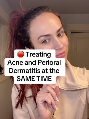 Acne and Perioral Dermatitis at the same time 😭 #acne #perioraldermatitis #nursepractitioner #sensitiveskin #sulfurcleanser #sulfur 