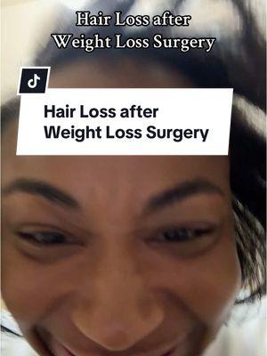 Replying to @Courtney 🧚🏾 hair loss after weight loss surgery #hairlossjourney #wlshairloss #vsghairloss #bariatriccommunity #wlscommunity #vsgcommunity #wlscommunityvsg #gastricsleeve #bariatricsurgery #wlsjourney #vsgjourney