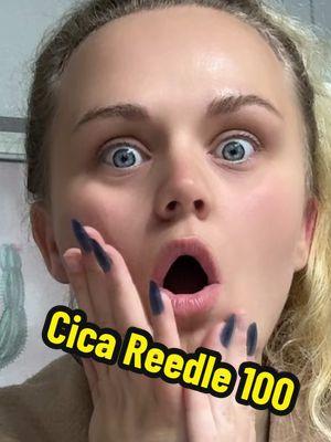 Nooo way this is real… Feels like you’re exfoliating your face with a serum/sugar scrub… but you can’t see the exfoliate in the serum with a naked eye… totally bizarre but it feels amazing nonetheless 🧖🏼‍♀️🧘‍♀️ Refines rough skin giving it a smoother appearance and sensational deep clean feeling😍🤌🏼 #cicareedleshot #reedleshot #reedleshot100 #cicareedle100 #exfoliate  #vtcosmetics #cosmetics #beauty #spa#spaaathome #beautyproducts #ma#makeupkintok #skincare #skincareroutine #skincaretips 