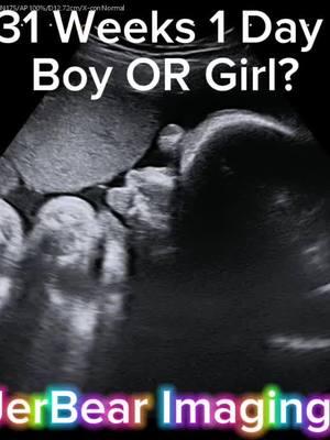 Boy OR Girl?💙🩷 #jerbearimaging #31weekspregnant #boyorgirl #baby #fyp #ultrasoundnearme #pinkorblue #blueorpink #girlorboy #heorshe #genderreveal #genderultrasound #brownwoodtx www.jerbearimaging.com