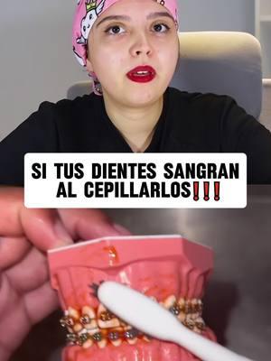 Si tus encías sangran, están hinchadas o tienes mal aliento, debes prestar atención.#toothpaste#yellowteeth #badbreath #teethwhitening #oralhealth #teethcleaning #tiktokmademebuyit #toothpaste#toothpaste #toothwhitening #gingivitis #badbreath #yellowteeth #teeth #tooth #Blandquear #teethwhitening #badbreath #toothdecay #sp6 #foryou #FYP#TikTokShop #TikTokMadeMeBuylt #tiktokshopbacktoschool :#tooth #teethcare #dealsforyoudays #teethwhitening #oralhealth#fyp #whiteningteeth #teeth #blanquear#tiktokshopholidayhaul #FallDealsForYou #tiktokshopblackfriday