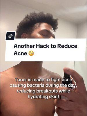 Toner is another great way to reduce acne! #acnetoner #acneproneskincare #skincareforacne #breakouts #morningskincare #nightskincare #acneprone 