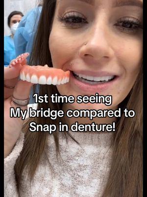 Its my fixed bridge 3 year birthday! Almost 6 years since i went in for a free consult w @Dr. Todd Shatkin & had my first 10 #minidentalimplants installed for #snapindentures 2 weeks after consult and before i ever made a payment!!  They helped find financing & a plan that worked for me & i have no regrets! I had my snap in #removabledenture for 3 years before upgrading to a fixed bridge permanent system that youre seeing my reaction to in this video. I was seeing my #temporarybridge i would wear for a couple weeks while the #permanentteeth were being #custommade #forme 😍#onthisday This surgery was filmed by @Refinery29 & i have links you can watch the entire #fixedbridgejourney & #dentalimplantsurgery #beforeandaftersnapindentures #beforeandaftertransformation #majordentalwork #dentalfear 