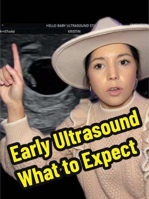 #greenscreenvideo #earlypregnancy #firsttrimester #1sttrimester #pregnant #ultrasound #sonographer #hellobaby #ultrasoundstudio #earlyultrasound #informational 