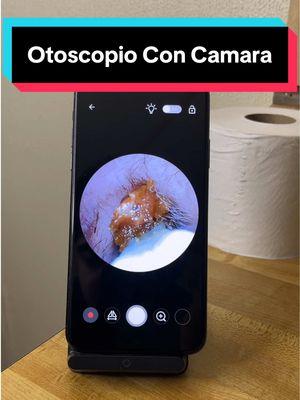 Otoscopio con camara #otoscopio #otoscopiosaltacalidad #cerumen #ceradeoidos #TikTokShopHolidayHaul 