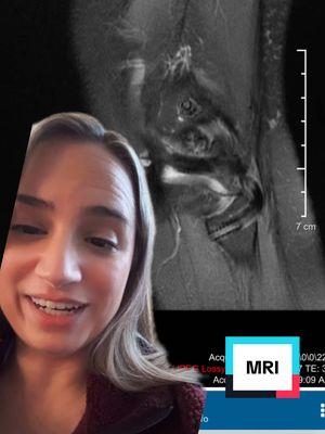 Replying to @Emmawolp MRIs hate to see me coming #sinkeysisters #nellythenerve #chronicinjuryrecovery #arthoscopysurgery #kneesurgerycheck #scartissue #mri #greenscreen  