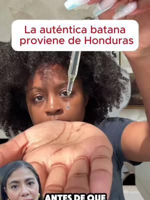 ¡Di adiós a la calvicie! ¡Esta hierba tiene efectos sorprendentes, ven y compruébalo!#hairstyles #hairloss #hairtutorial #haircut #tips #hairgrowth #batanaoil #healthyrecipes #alopecia #hair #regrowhair #batanaoilbenefits