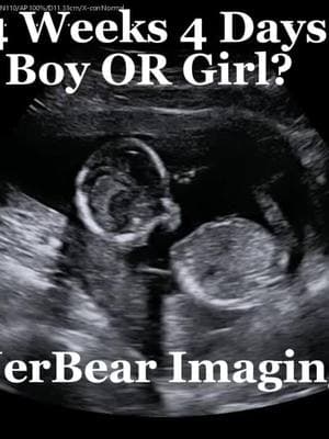 What do you think? #jerbearimaging #boyorgirl #baby #girlorboy #ultrasoundnearme #blueorpink #fyp #genderultrasound #heorshe #genderreveal #pinkorblue #brownwoodtx www.jerbearimaging.com