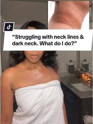 🌟 For neck lines/wrinkles & Hyperpigmentation. Please ensure the pigmentation on your neck is not caused by an underlying health issue. If it is, address the condition promptly. - #necklines #darkneck