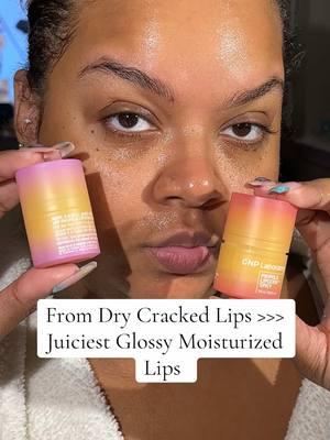 Please tell me you guys see the differnce! #kbeauty #koreanskoncare #koreanlipcare #drylips #lippropolis #lipbalm #crackedlips #chappedlips #bestproductsfordrylips 