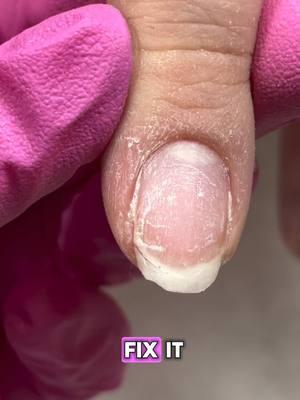 How to repair a crack on a nail #nailrepair #nailbreak #diynails #gelnails #nailtutorial #nailvideos #nailtech #kokoist #fiberglassnails #structuredgelmanicure 