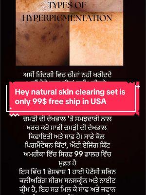 #hey_natural skincare #foryou #foryoupage  #eventoneskin  #skinlightening #skinbleaching #naturalingredients  #usawale  #canadawale #usadesi #desitiktok #viral  #viralvideo #pakistan #dubaidesi #UAE #uk #europe #viralreels #viralvideo #india #bollywood #acne #pigmentation #hey_natural skincare #foryou #foryoupage  #eventoneskin  #skinlightening #skinbleaching #naturalingredients  #usawale  #canadawale #usadesi #desitiktok #viral  #viralvideo #pakistan #dubaidesi #UAE #uk #europe #viralreels #viralvideo #india #bollywood #acne #pigmentation #desi #punjabi #punjabisongs #sidhumoosewale #punjab  #student #harvana #heynatural #heynaturaleeurope  #go viral  # trending  #LifeOnTikTok#desi #punjabi #punjabisongs #sidhumoosewale #punjab  #student #harvana #heynatural #heynaturaleeurope  #go viral  # trending  #LifeOnTikTok  #monetizedviews  #maskat waly  #bangladeshi   #foryou #foryoupage #yp #fyp #viralvideo #fyp≥* viral 