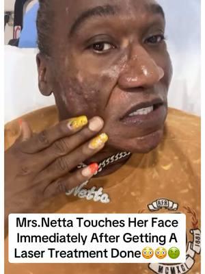 Mrs.Netta Gets Her 10th Laser Treatment Done Today @Pretty Faces Atlanta By Dr.Jing Jing😳🫣🤥 #msnetta #fyp #msnettaandcharles #charlesyourlunchisready #viralvideo #fyppoppppppppppppppppppppppp 