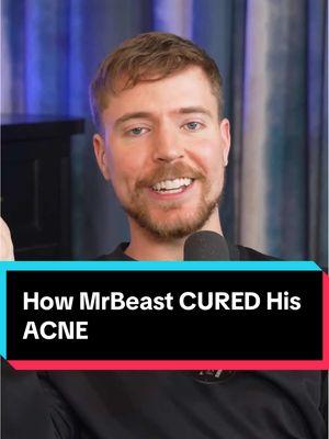 How @MrBeast CURED His ACNE #mrbeast #theovon #theovonpodcast 