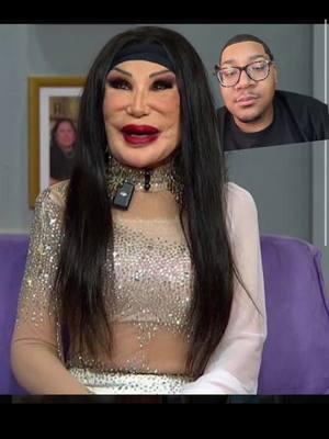 #greenscreen Poor Lyn May, she was strinkingly beautiful, no one deserves that. 😢 #LynMay #Danielfunnyashell #Nostalgia #botched #plasticsurgery #Fyp 