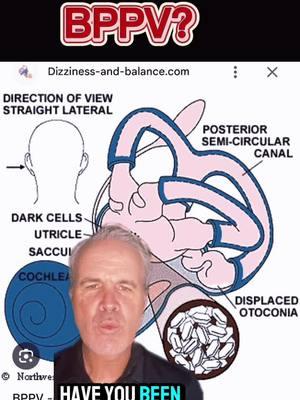 #bppv #dizzy #vertigo #epleymaneuver #fyp #uccnearme #vestibular 